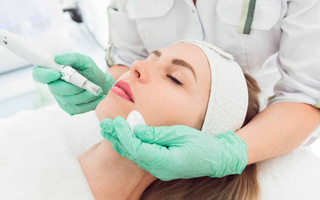 What Benefits Does Microneedling Provide?