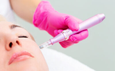 The Diverse Benefits of Microneedling