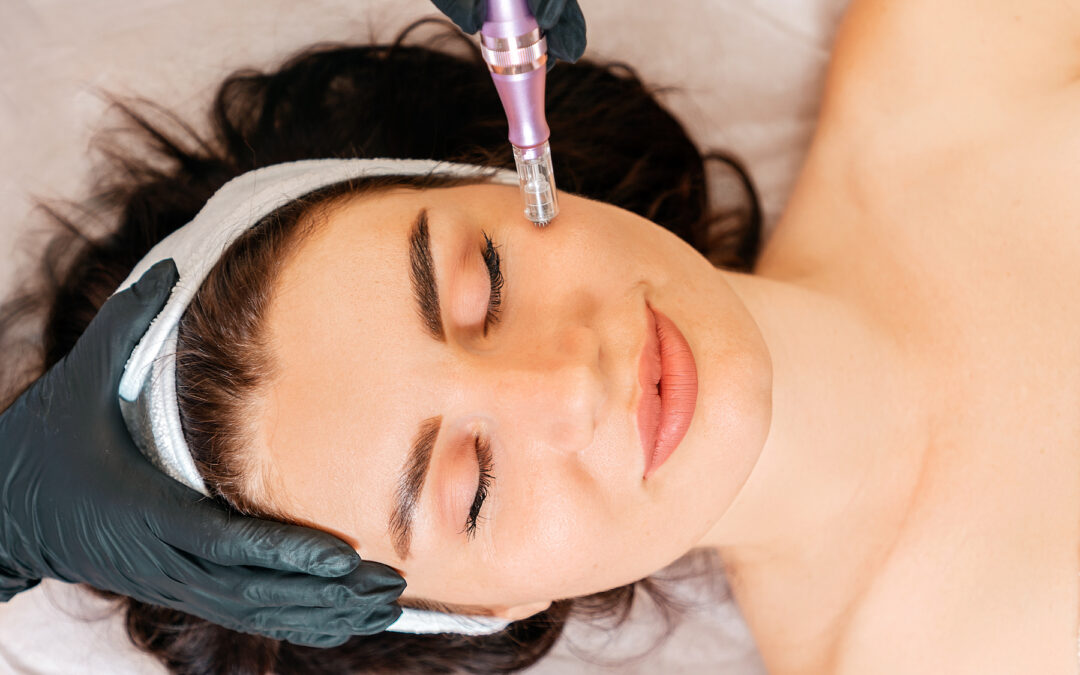 Have Your Skin Looking Its Best for the Fall with Microneedling