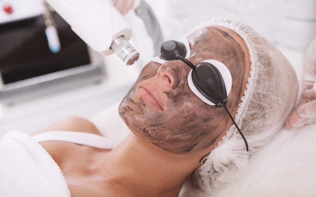 Fall in Love with the Hollywood Carbon Facial