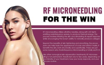 Rejuvenate Your Skin with RF Microneedling