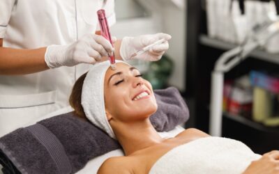 Microneedling with Chemical Peels: A Complete Guide