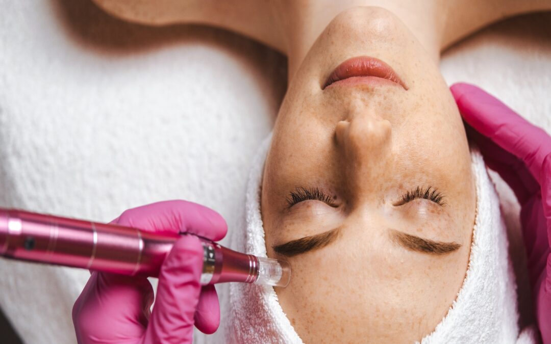 Microdermabrasion vs. Microneedling: Achieving Youthful & Beautiful Skin