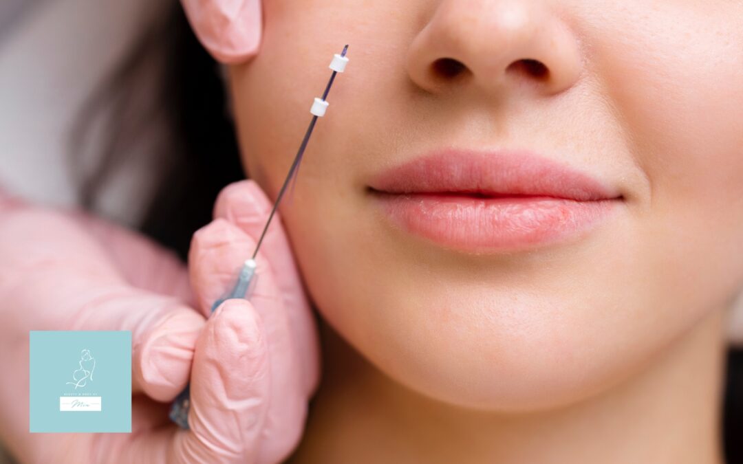 Everything You Need to Know About Thread Lifts