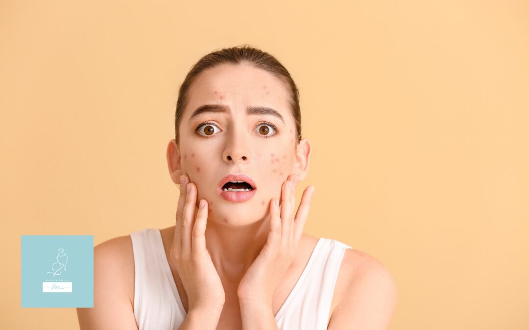 How Stress Affects Your Skin and What Treatments Can Help