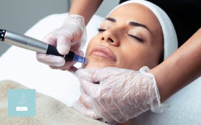 What to Expect After Your First RF Microneedling Session