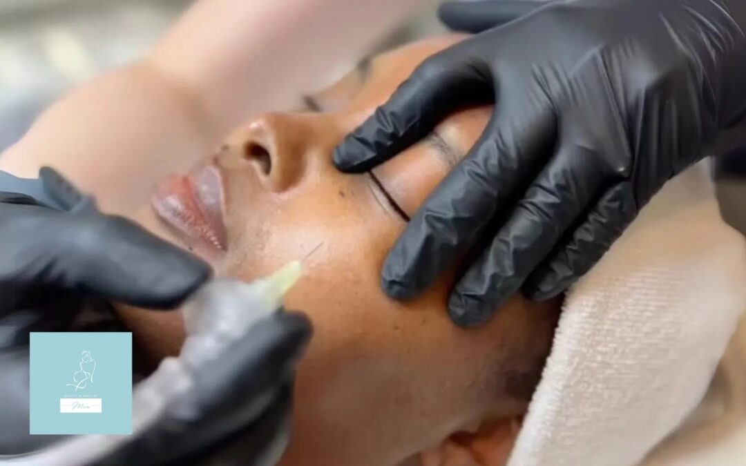 Explained: What Is Carboxy Therapy and Why It’s Trending