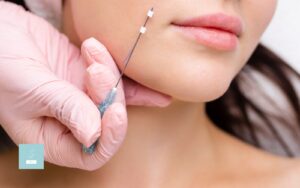 How Do Thread Lifts Turn Back the Clock?