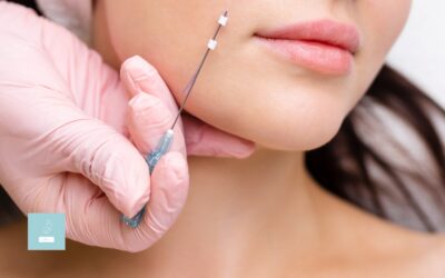 How Do Thread Lifts Turn Back the Clock?