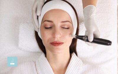Benefits of RF Microneedling for Skin Texture and Tone