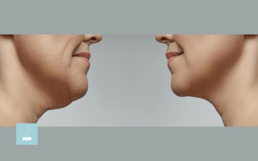 Ultherapy and Thermage: Choosing the Right Non-Surgical Skin Tightening Treatment for Your Goals