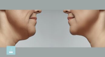 Pros and Cons of Lemon Bottle Fat Dissolving